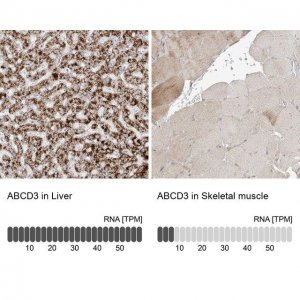 Anti-ABCD3 antibody produced in rabbit 