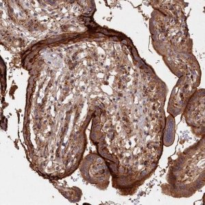Anti-ABHD14B antibody produced in rabbit HPA036642-100UL