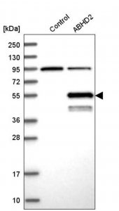 Anti-ABHD2 antibody produced in rabbit 
