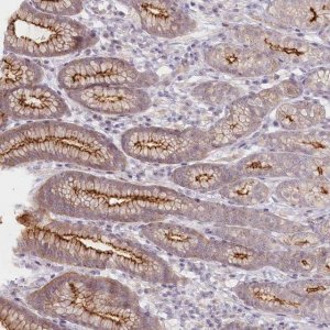 Anti-ABHD8 antibody produced in rabbit 