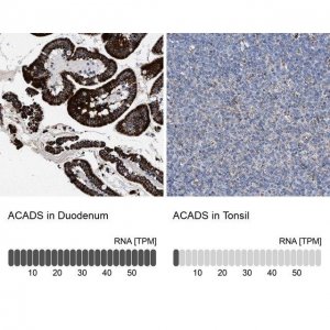 Anti-ACADS antibody produced in rabbit 