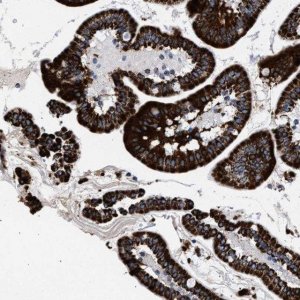 Anti-ACADS antibody produced in rabbit 
