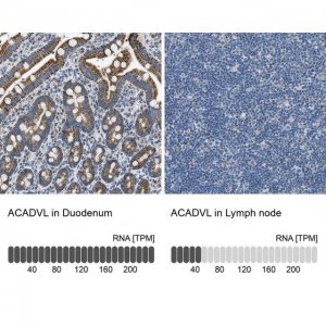 Anti-ACADVL antibody produced in rabbit 