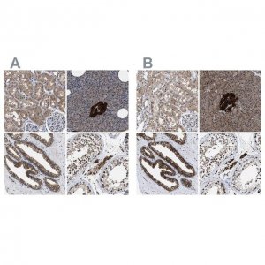 Anti-ACLY antibody produced in rabbit HPA022953-100UL