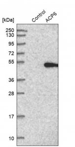 Anti-ACP6 antibody produced in rabbit 