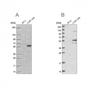 Anti-ACSBG1 antibody produced in rabbit 