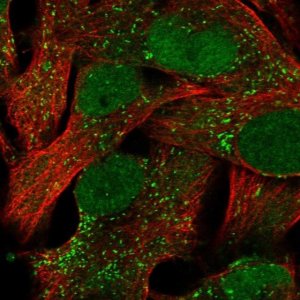 Anti-ACSBG1 antibody produced in rabbit 