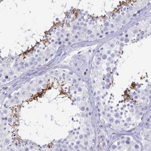 Anti-ACSBG2 antibody produced in rabbit 