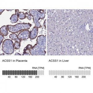Anti-ACSS1 antibody produced in rabbit 