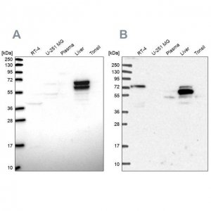 Anti-ACSS3 antibody produced in rabbit 