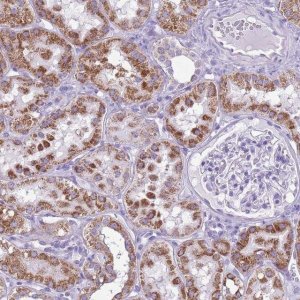 Anti-ACSS3 antibody produced in rabbit 