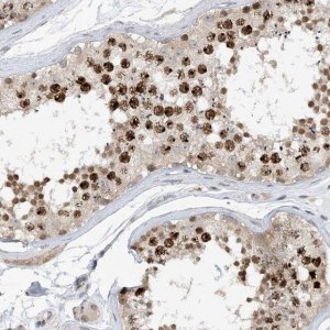 Anti-ACYP2 antibody produced in rabbit 