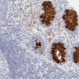 Anti-ADAM30 antibody produced in rabbit HPA026080-100UL