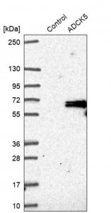 Anti-ADCK5 antibody produced in rabbit 