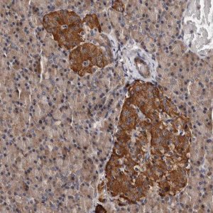Anti-ADCK5 antibody produced in rabbit 