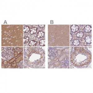 Anti-ADD1 antibody produced in rabbit 