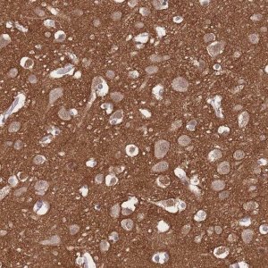 Anti-ADD2 antibody produced in rabbit 