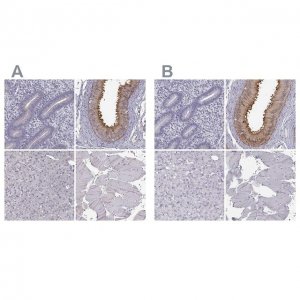 Anti-ADGRG2 antibody produced in rabbit 