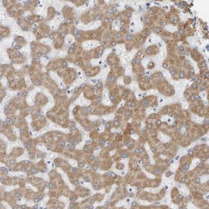 Anti-ADHFE1 antibody produced in rabbit 