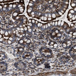 Anti-AGPAT2 antibody produced in rabbit 