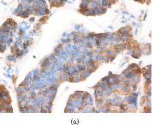 Anti-AGR2 antibody produced in rabbit 