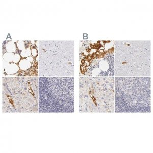 Anti-AHSG antibody produced in rabbit 