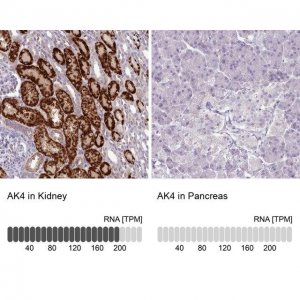 Anti-AK4 antibody produced in rabbit 