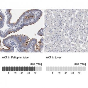 Anti-AK7 antibody produced in rabbit 