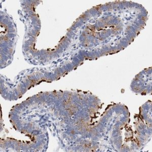 Anti-AK7 antibody produced in rabbit 