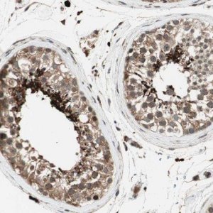 Anti-AKAP1 antibody produced in rabbit 