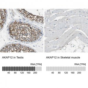 Anti-AKAP12 antibody produced in rabbit 