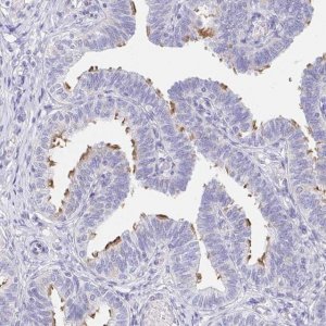 Anti-AKAP14 antibody produced in rabbit 