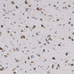 Anti-AKAP9 antibody produced in rabbit 