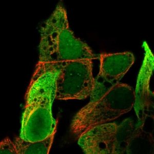 Anti-AKR1C1 antibody produced in rabbit HPA068265-100UL