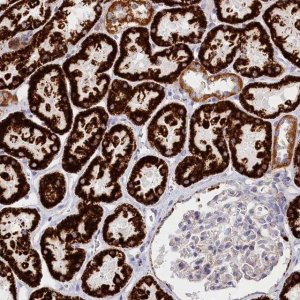 Anti-AKTIP antibody produced in rabbit 