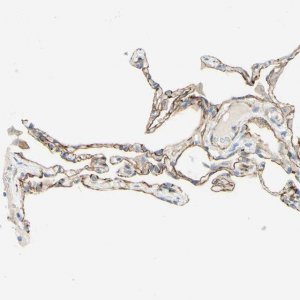Anti-ALCAM antibody produced in rabbit 