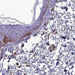 Anti-ALDH3B2 antibody produced in rabbit 