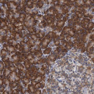 Anti-ALG2 antibody produced in rabbit 