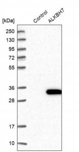 Anti-ALKBH7 antibody produced in rabbit 