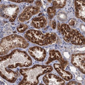 Anti-ALKBH7 antibody produced in rabbit 