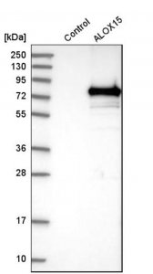 Anti-ALOX15 antibody produced in rabbit 