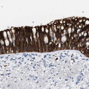 Anti-ALOX15 antibody produced in rabbit 