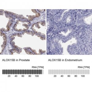 Anti-ALOX15B antibody produced in rabbit 