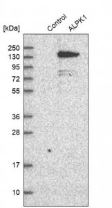 Anti-ALPK1 antibody produced in rabbit 