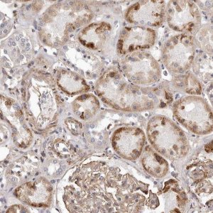 Anti-ALPK1 antibody produced in rabbit 