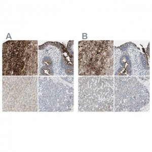 Anti-ALPL antibody produced in rabbit 