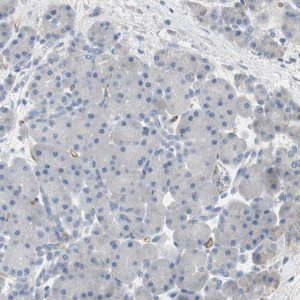 Anti-ALPL antibody produced in rabbit 