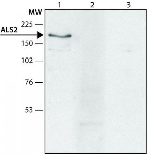 Anti-ALS2 antibody produced in rabbit 