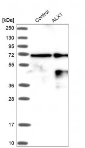 ANTI-ALX1 antibody produced in rabbit 
