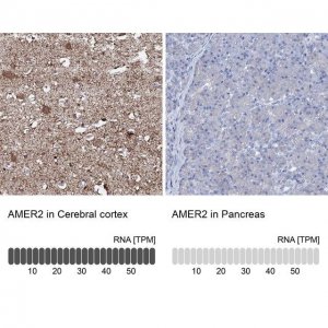 Anti-AMER2 antibody produced in rabbit 